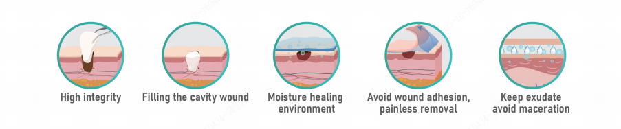 Comparing Antimicrobial Agents: Silver vs. PHMB in Modern Wound Care