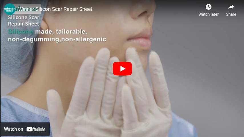 Silicon Scar Repair Sheet, Wound Care Products